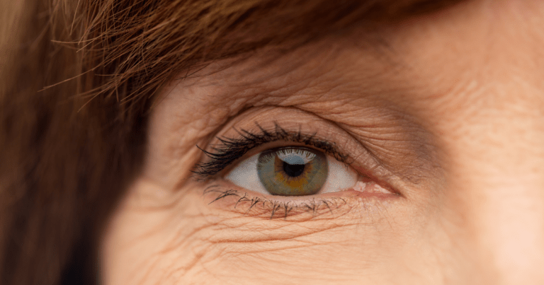 The image shows part of a woman's face with wrinkles